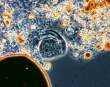 Бактерии нефтепродуктов